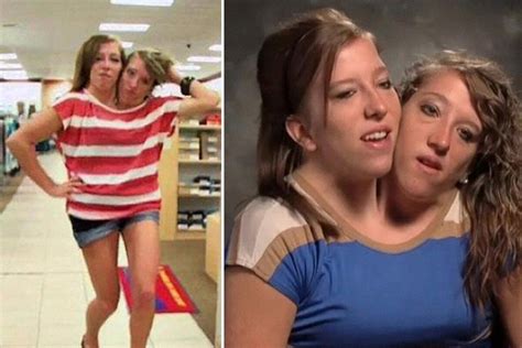 twitter bagets sex|Conjoined Twins Abby and Brittany Hensel Posted Details About .